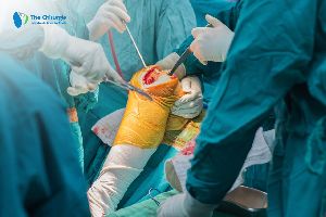 Knee Replacement Surgeon in India
