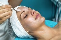 Chemical Peel Treatment