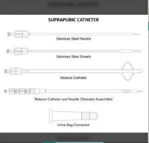 Suprapubic Catheter