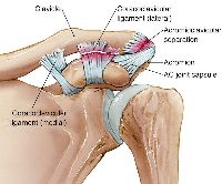 Arthritis and AC Joint Dislocation Treatment Surgery