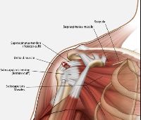 Rotate Cuff Injury Treatment Surgery