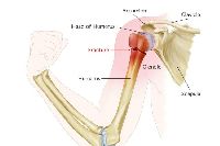 Shoulder Fractures Treatment