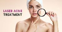 Acne Scar Reduction Treatment In Gurgaon