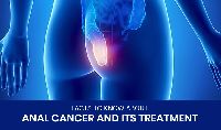 Anal Cancer Treatment in India