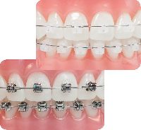 Orthodontic Treatment Services