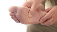 Diabetic Foot Ulcers Stem Cell Treatment Services