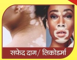 Ayurvedic Treatments