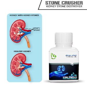 Kidney Stone Crush Medicine