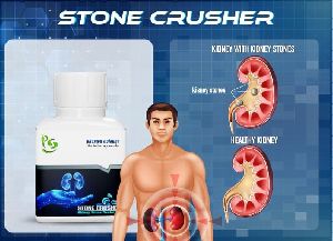 Primary Kidney Stone Crusher