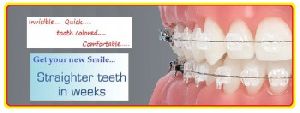 dental braces treatment in Delhi.