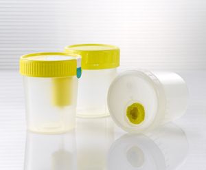 Urine Beakers