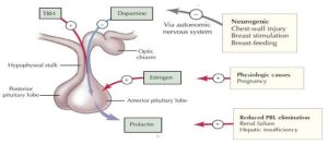 Hyperprolactinemia Treatment