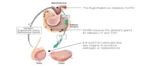 Hypogonadotropic Hypogonadism Treatment