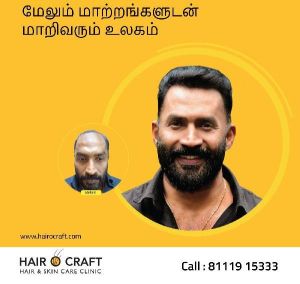 Hair Transplantation