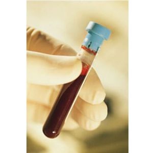 Blood Sugar Test Tube