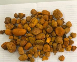 Ox Bezoar Cow Gallstones