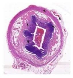 Appendix Prepared Histology Glass Slide