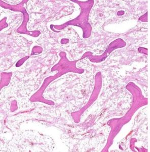 Cancellous Bone Prepared Histology Slide