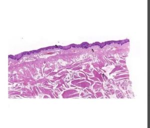 Oral Histology Cheek Mucosa Slide