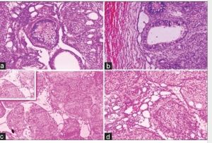 Digital Slides Of Odontogenic Tumors