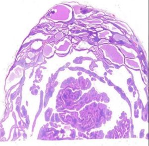 Epithelial Tumour Digital Slides Set