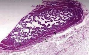 Histology Gall Bladder Slide