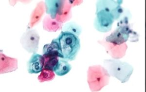 Gynae Cytology Digital Slides Set