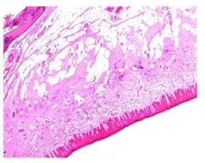 Hard Palate Anterior Adult Oral Histology