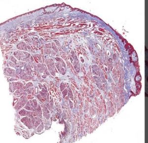 Masson Trichrome Stain