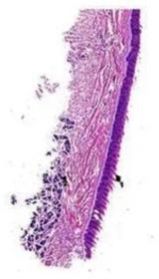 Oral Histology Filiform Papillae Tongue