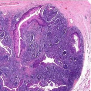 Oral Histology Parotid Gland