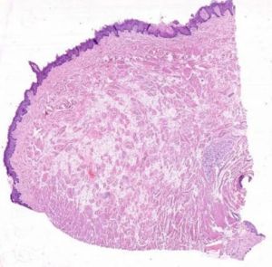 Oral Histology Slide Fungiform Papillae Tongue