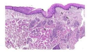 Oral Mucosa Histology Slide