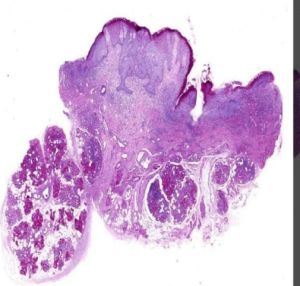 PAS Special Stain Prepared Microscope Slides