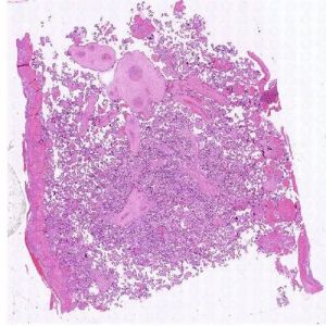 Placenta Microscope Slide