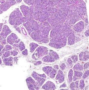 Saliivary Gland Lesions Digital Slides Set