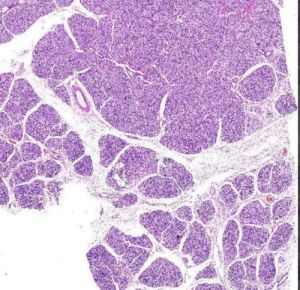 Salivary Gland Lesions Digital Slides