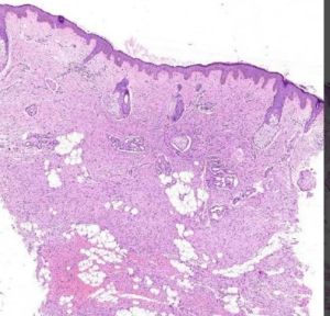 Sebaceous Glands Microscope Slides