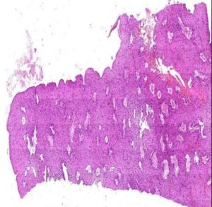 Secretory Endometrium Prepared Microscope Slides