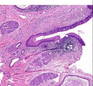 Taste Bud Oral Histology Prepared Slide