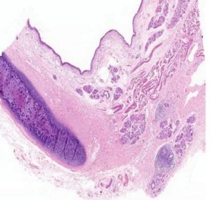 Trachea Histology Slide
