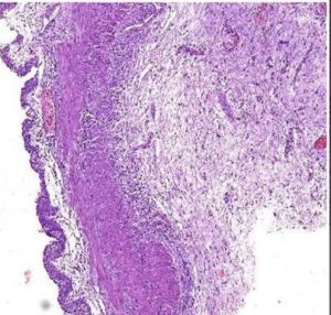 Transitional Epithelium Histology Slide