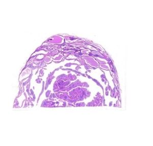 Tumors Pathology Microscope Slide