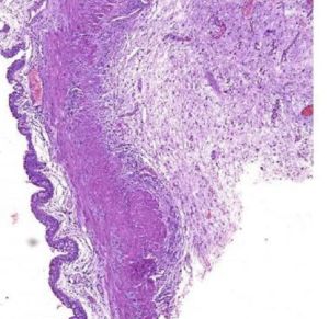 Urinary Bladder Histology Slide