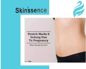 Stretch Marks/Scar Removal