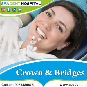 crown braces treatment service