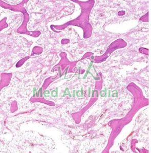 Cancellous Bone Prepared Histology Slide Standard For Clinical, Laboratory