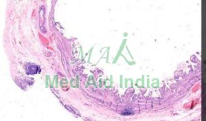 Transparent Rectangular Plain Clonorchiasis Gall Bladder, For Clinical, Laboratory, Size : Standard