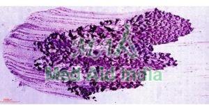 Digital Slides of Non Gynae Cytology