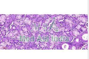 E Slide Of Epithelial Lesions, For Clinical, Laboratory, Feature : Eco Friendly, Superior Quality